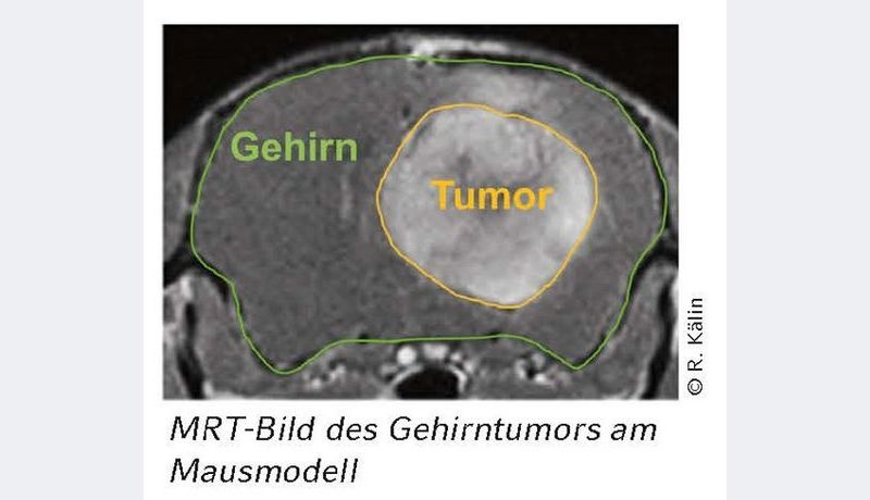 Gehirntumor einer Maus; Credit: Kälin